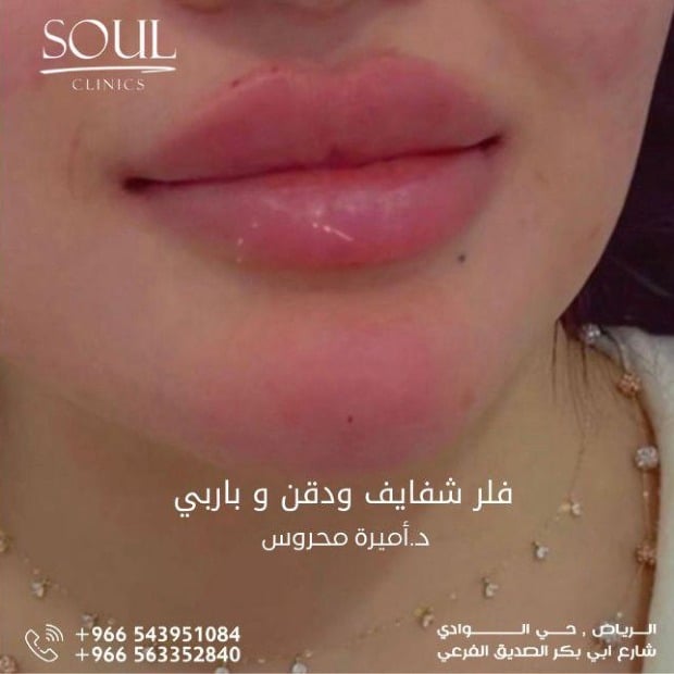 Soul clinics image-slider-5
