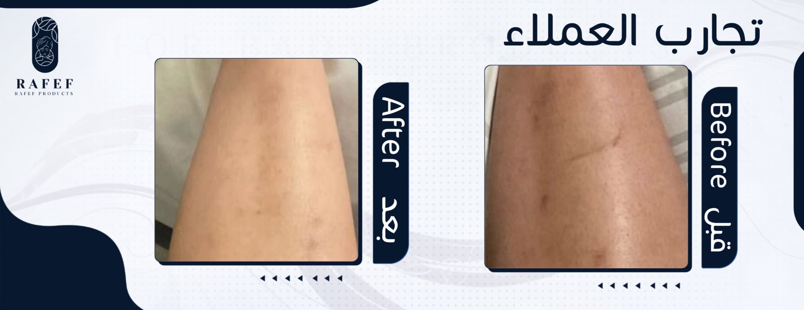 متجر رفيف image-slider-1