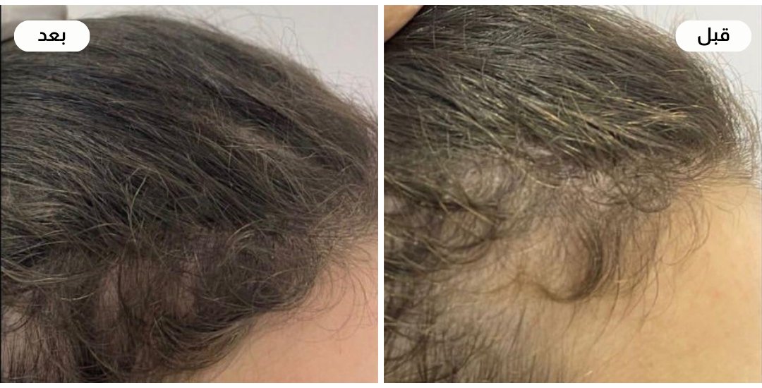 Najla care image-slider-2