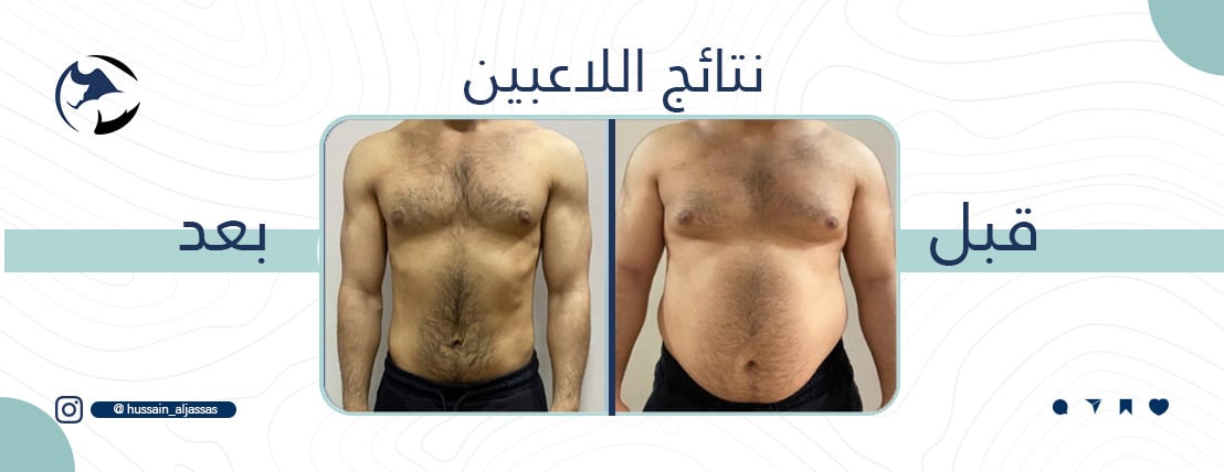 مدرب شخصي حسين جساس image-slider-5