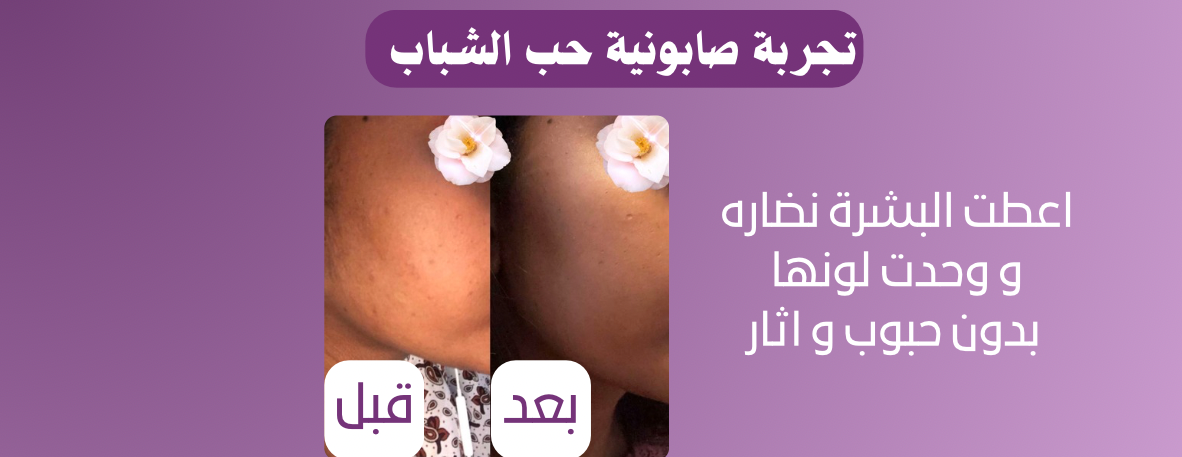 متجر الاوركيد image-slider-4