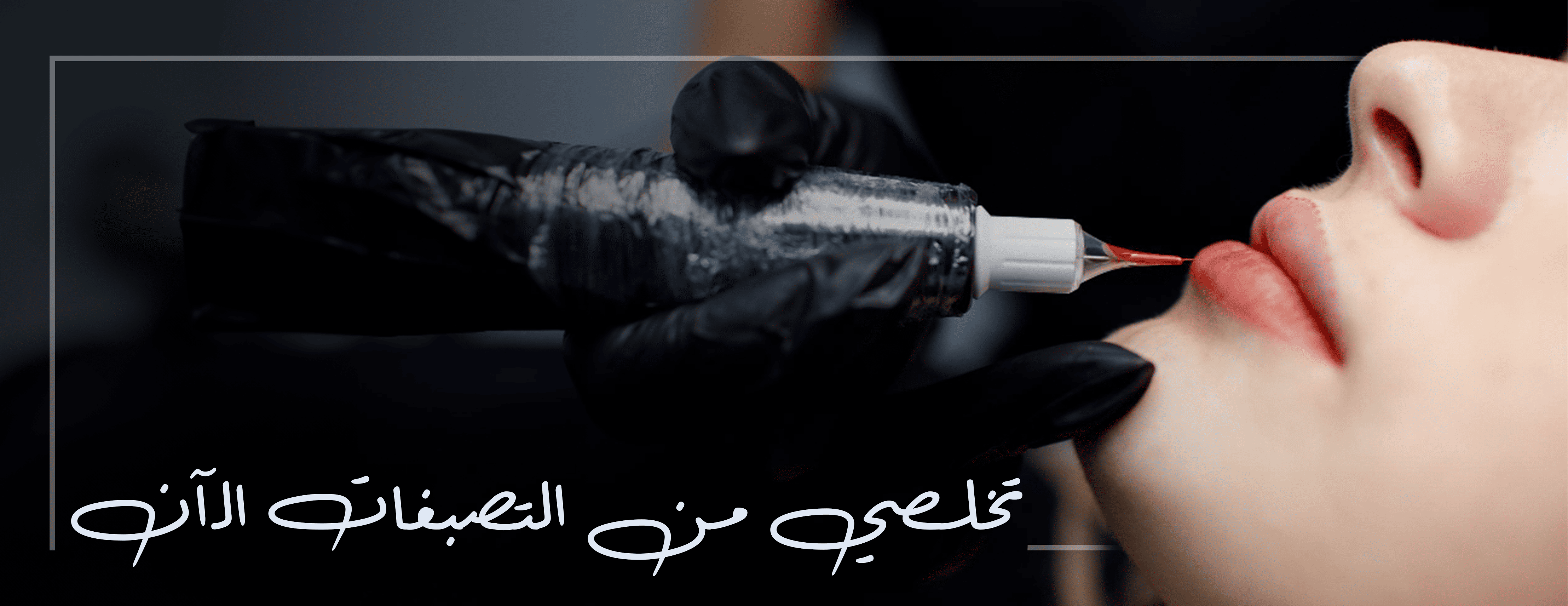 fixed banner