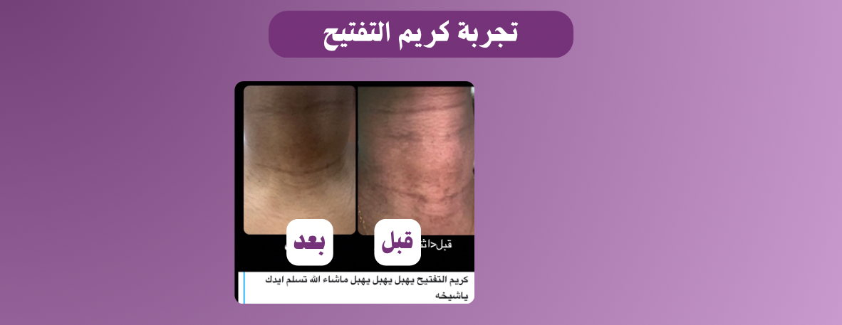 متجر الاوركيد image-slider-3