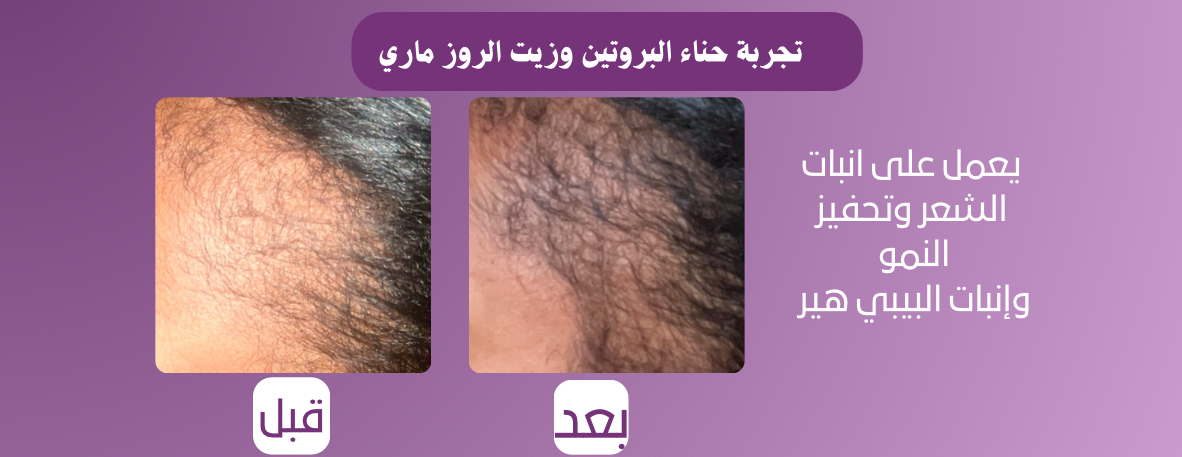 متجر الاوركيد image-slider-5