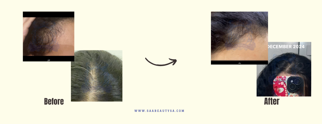 SAA BEAUTY image-slider-0