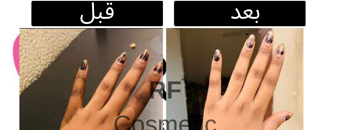 RF image-slider-4