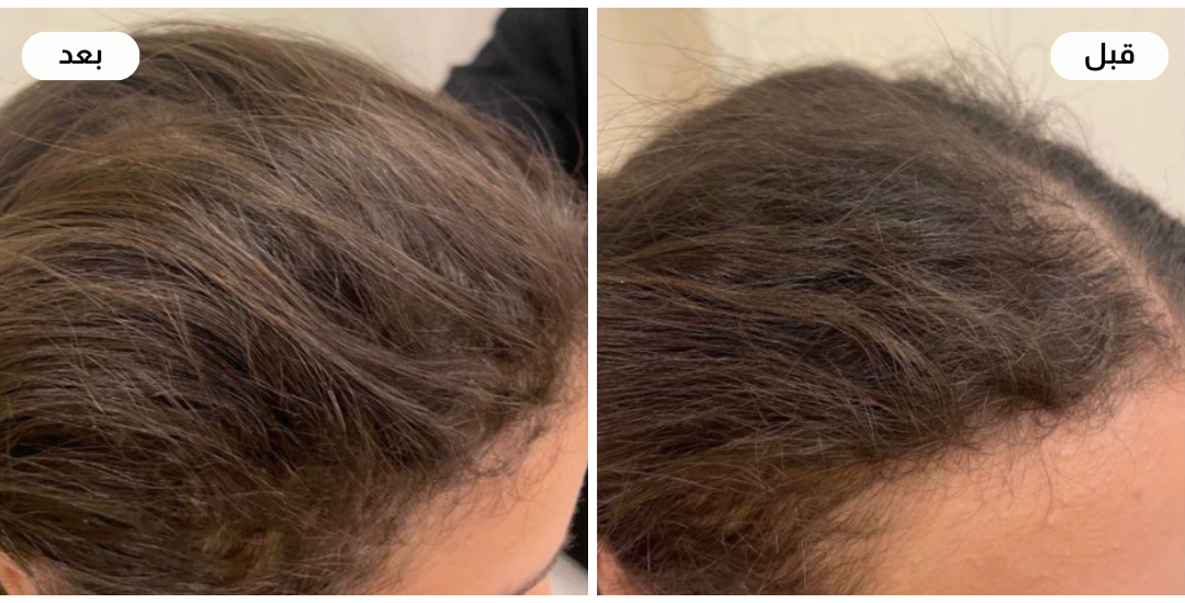 Najla care image-slider-4