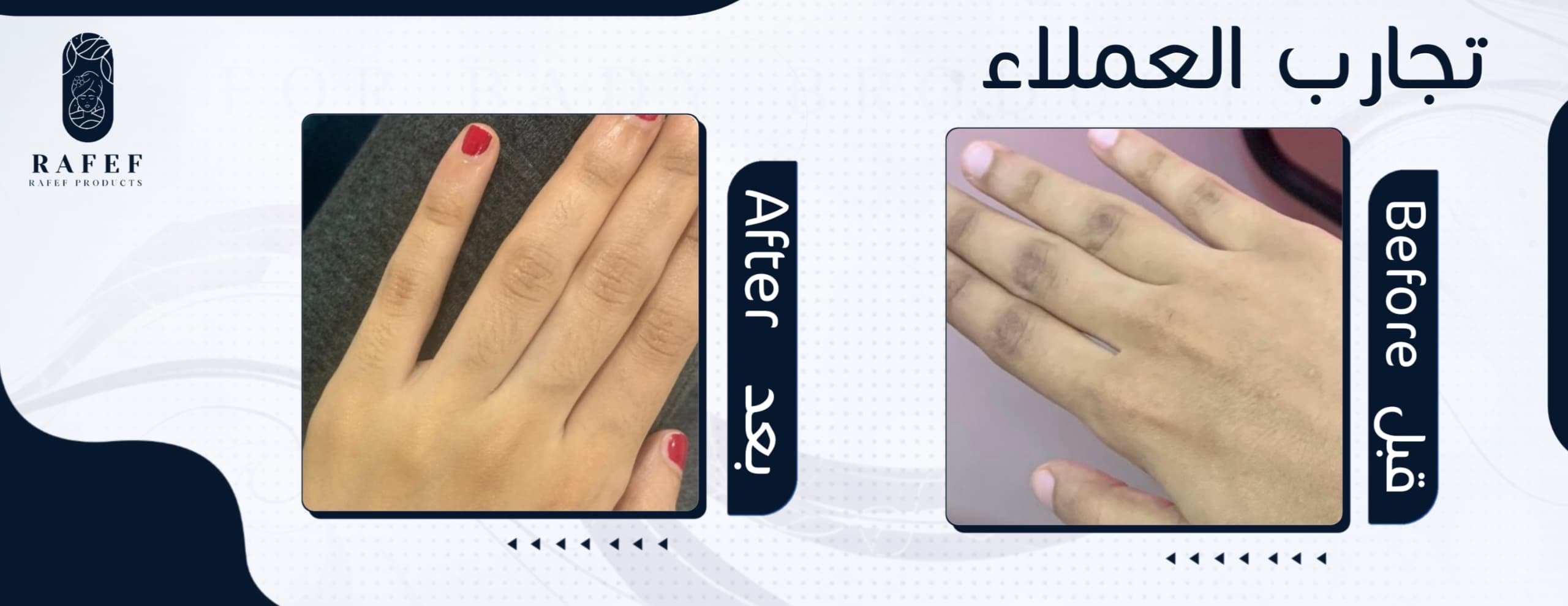 متجر رفيف image-slider-0
