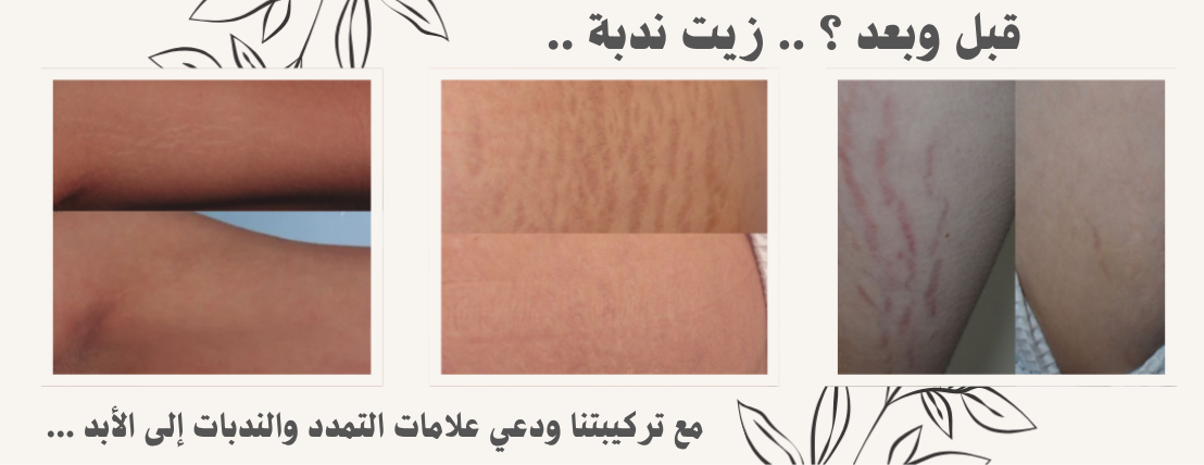 Eman Glow image-slider-1
