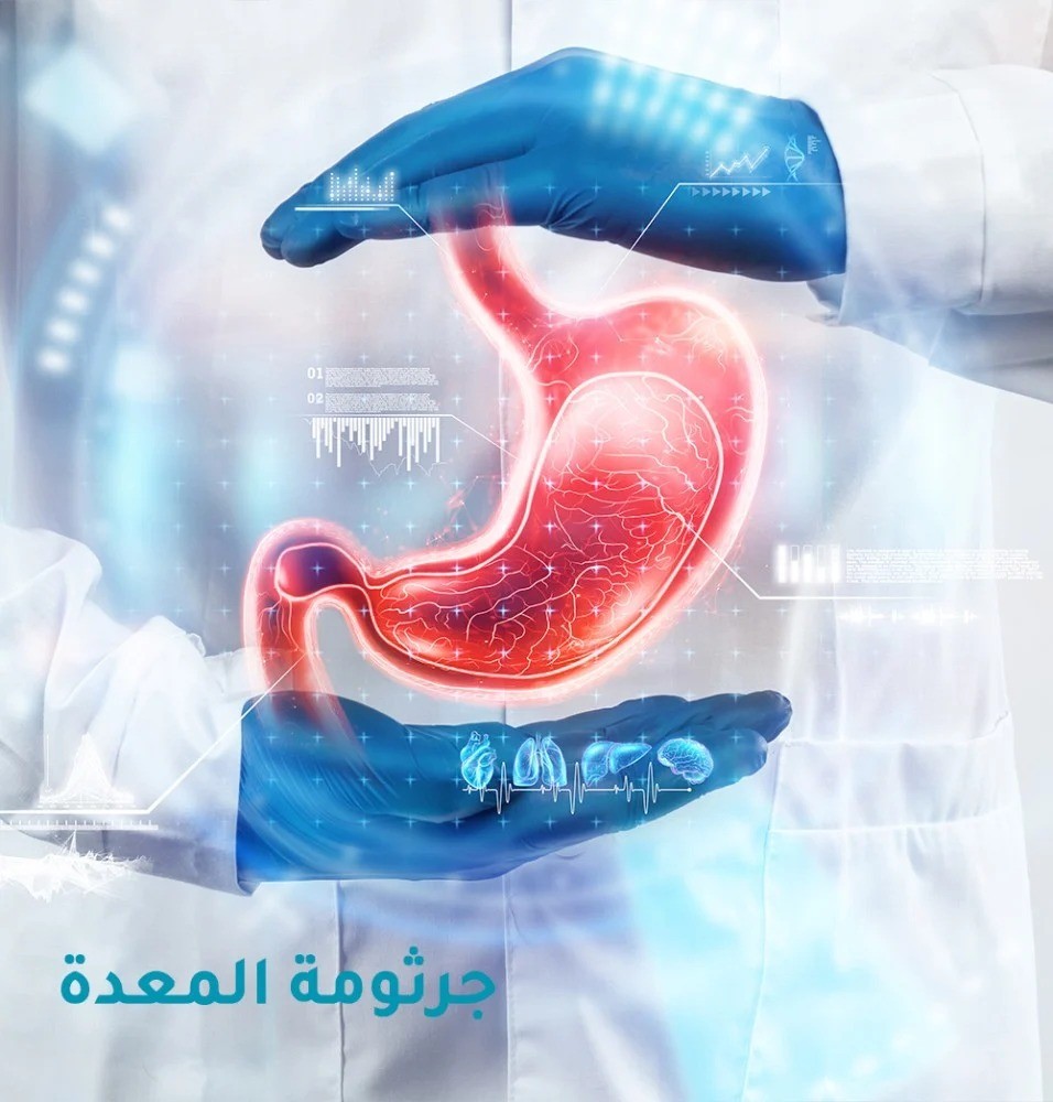 اسرع علاج لجرثومه المعده من ذا سول في السعودية بافضل سعر