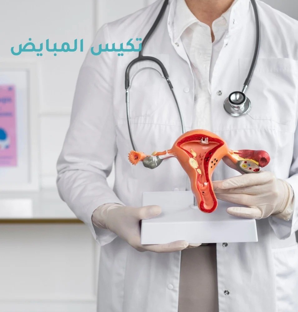 برامج تكيسات المبايض من ذا سول في السعودية