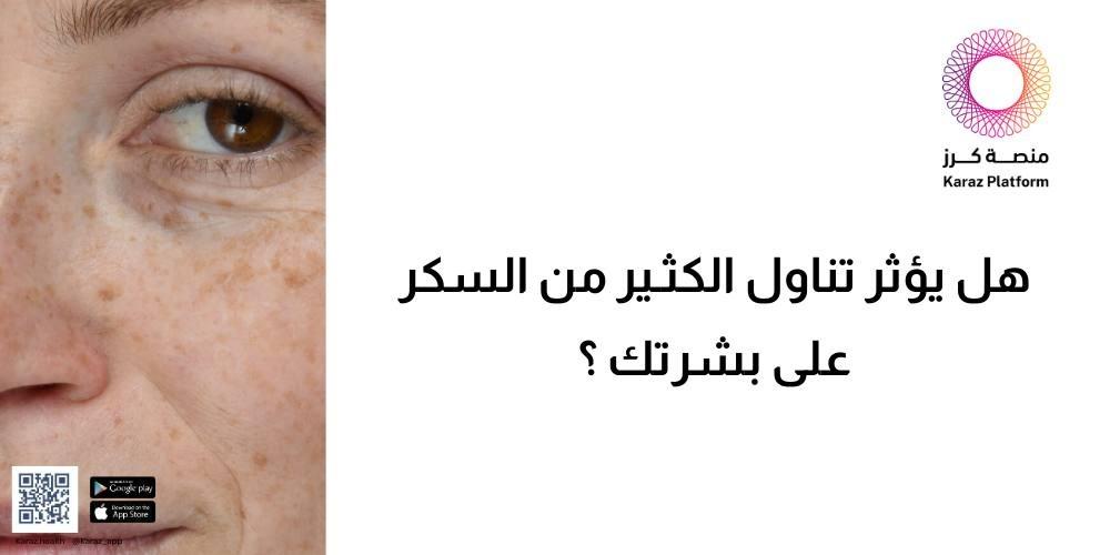 هل يؤثر تناول الكثير من السكر على بشرتك ؟