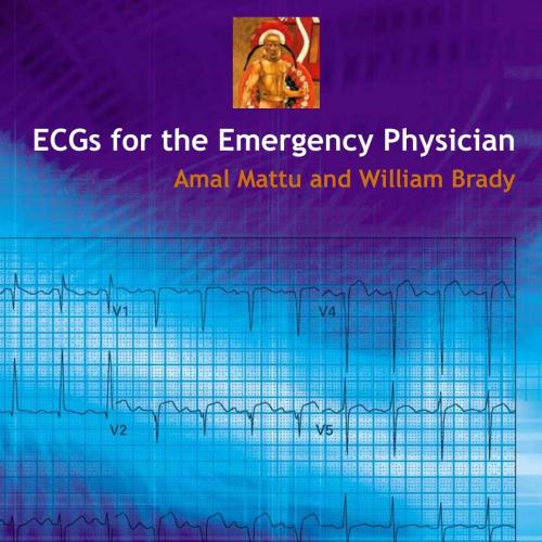 ECGs for the Emergency Physician