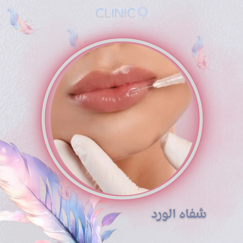 جلسة شفاه الورد Rose Lips لتوريد الشفاه