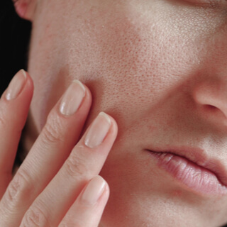 How to overcome excess skin oil?