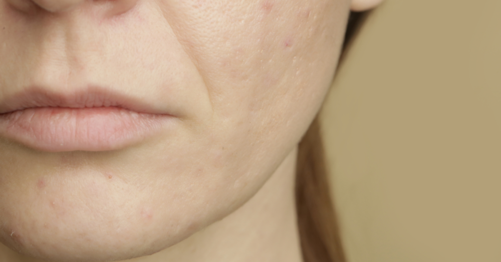 Important basics for healthy and glowing skin