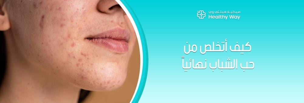 كيف أتخلص من حب الشباب نهائياً عبر روتين عناية متكامل