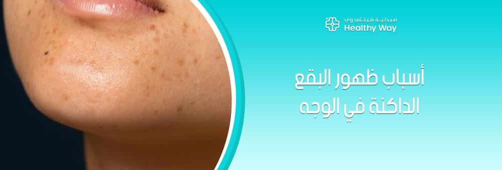 أسباب ظهور البقع الداكنة في الوجه وكيفية الوقاية منها