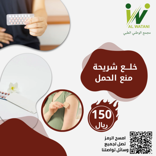 خلع شريحة منع الحمل