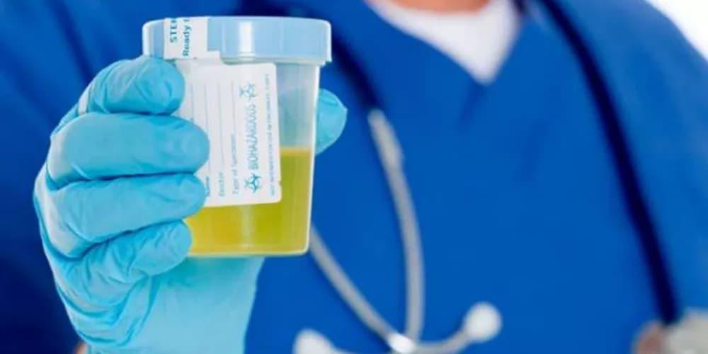 كم مدة بقاء المخدرات في البول لغير المدمن؟