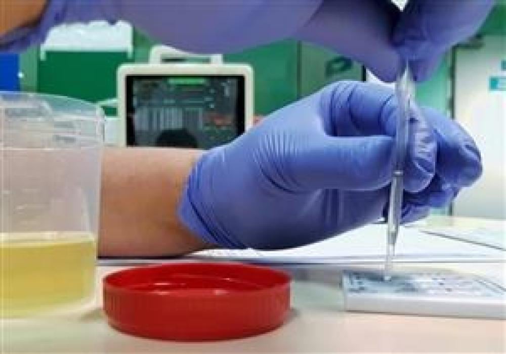 نموذج تحليل المخدرات من الكواشف السريعة، تواصل على