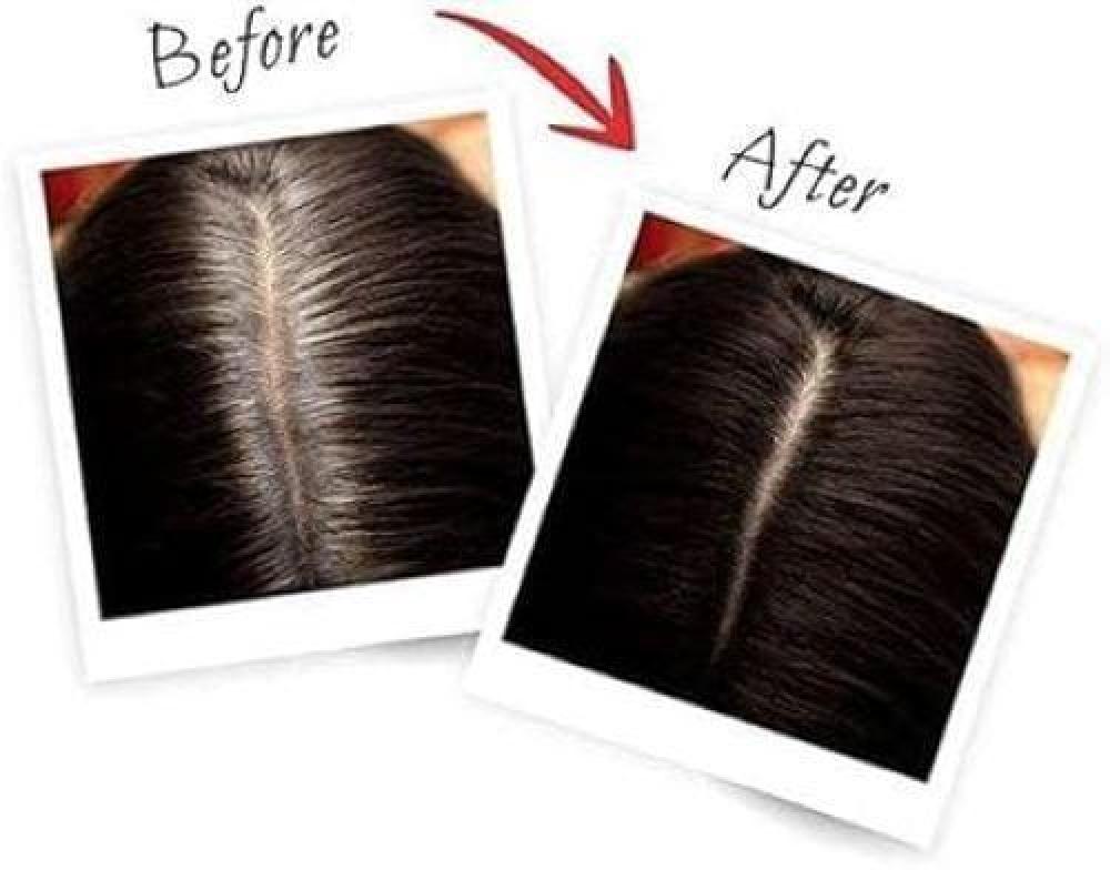 بخاخ فوري ماجيك تاتش لاخفاء لون الشعر من ماركة لوريال - بني ذهبي