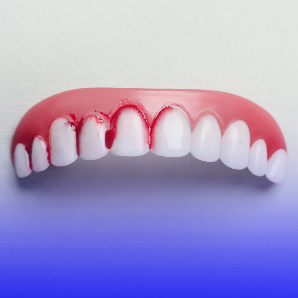 علاج التهابات اللثة