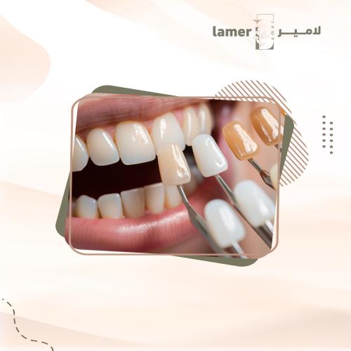 تركيبة الايماكس