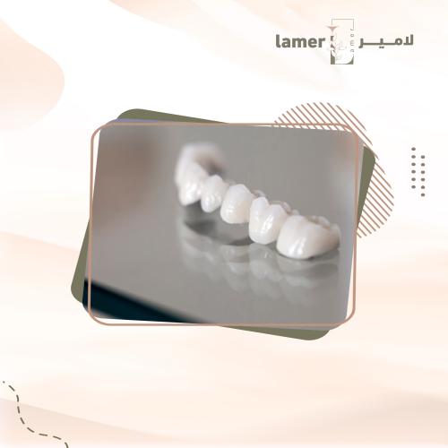 تركيبة البورسلين