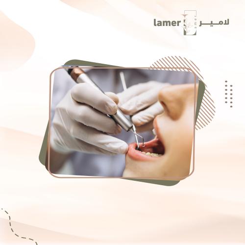 حشوات تبدأ من