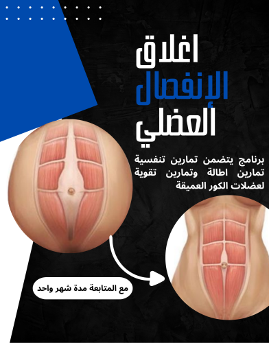 برنامج اغلاق الانفصال العضلي