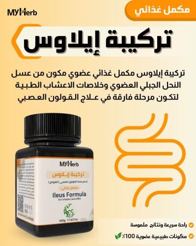 تركيبة إيلاوس