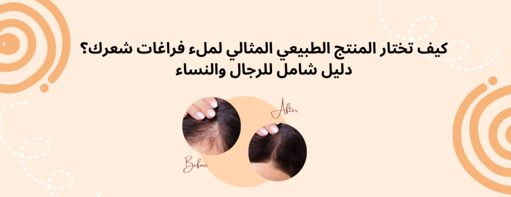 كيف تختار المنتج الطبيعي المثالي لملء فراغات شعرك؟ دليل شامل للرجال والنساء