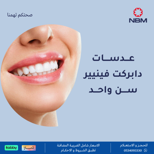 عدسات دابركت فينيير سن واحد