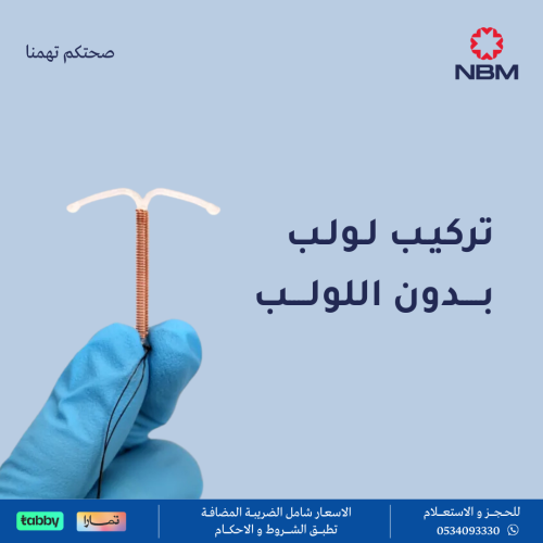 تركيب لولب بدون اللولب