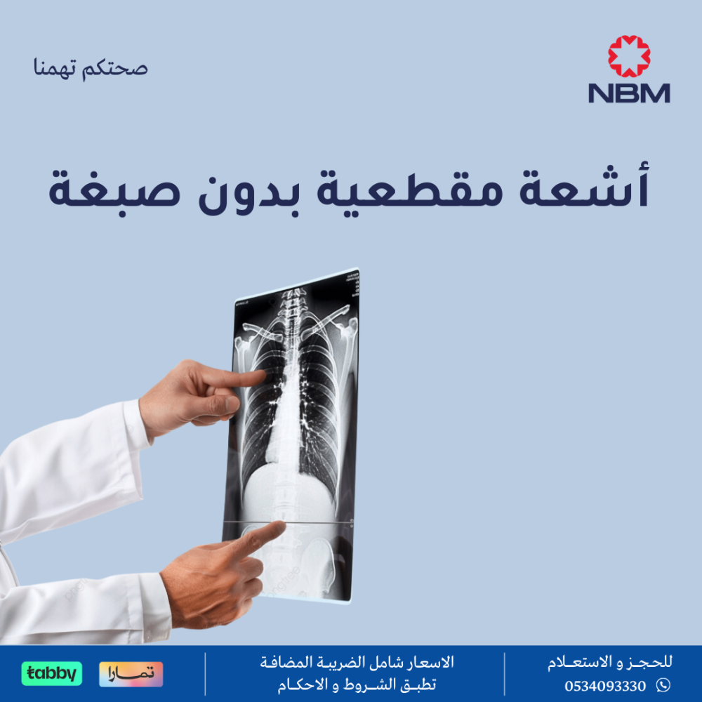 أشعة مقطعية بدون صبغة