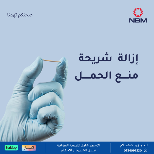 إزالة شريحة منع الحمل