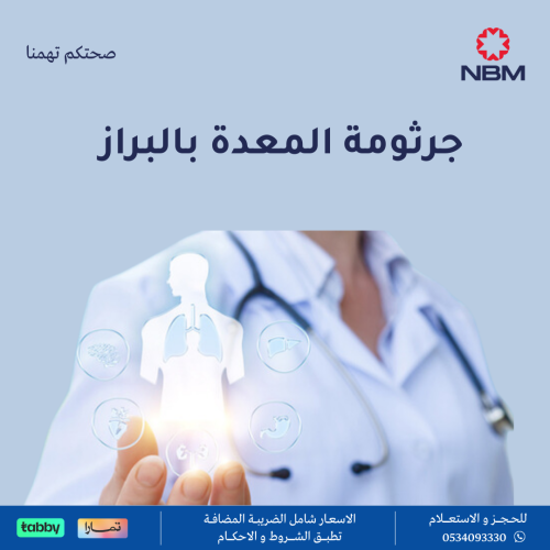 جرثومة المعدة بالبراز