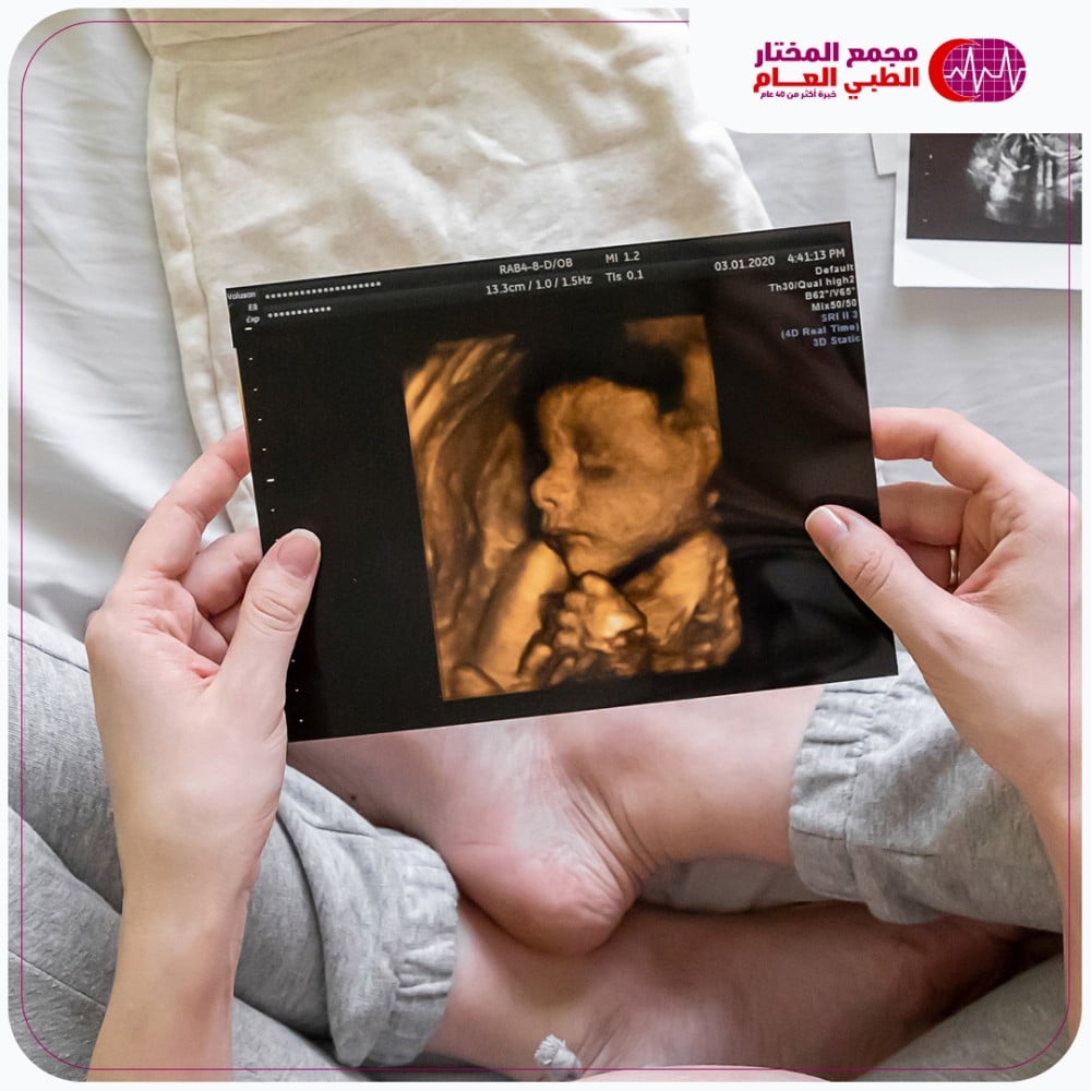 السونار الرباعي لتحديد الجنس فقط