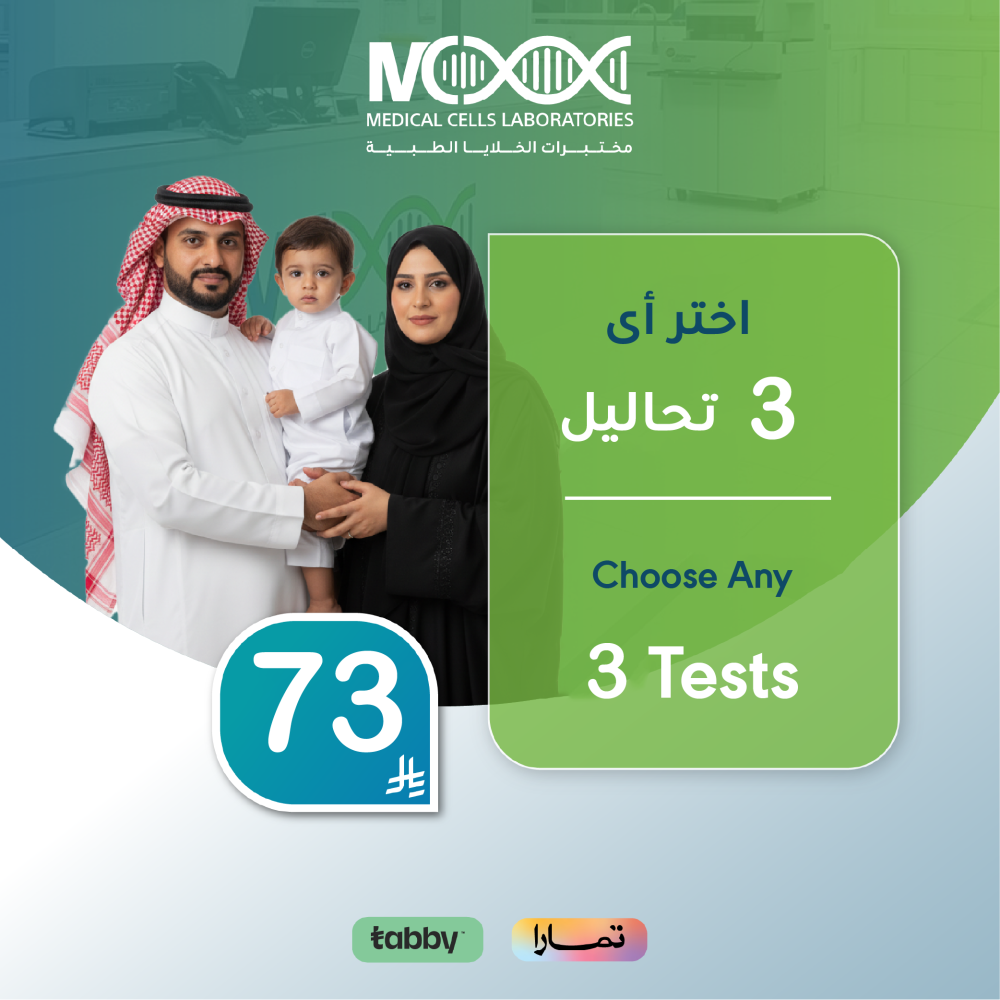 اختر اي 3 تحاليل ب 73 ريال