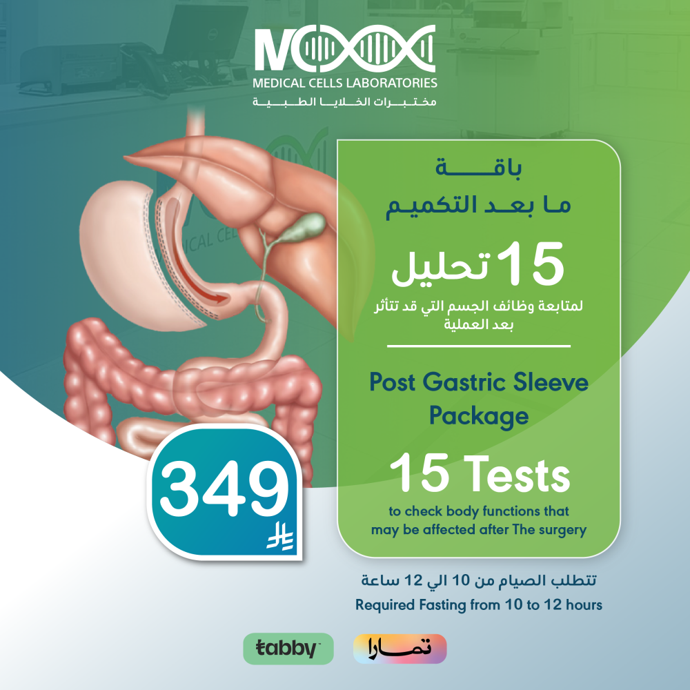 Post gastric sleeve tests