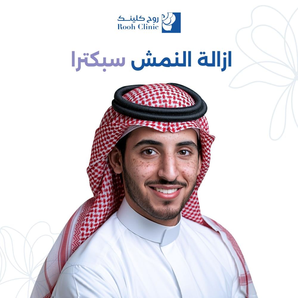 إزالة النمش - سبكترا