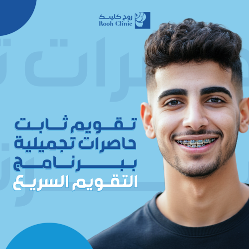 تقويم ثابت حاصرات تجميلية