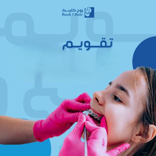 تقويم فكين حالة الدرجة الثالثة
