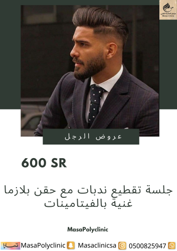 جلسة تقطيع ندبات مع حقن بلازما غنية بالفيتامينات