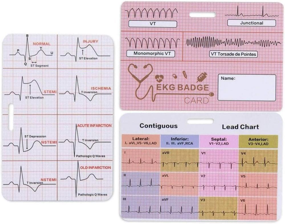 بطاقة مرجعية لتخطيط القلب ECG