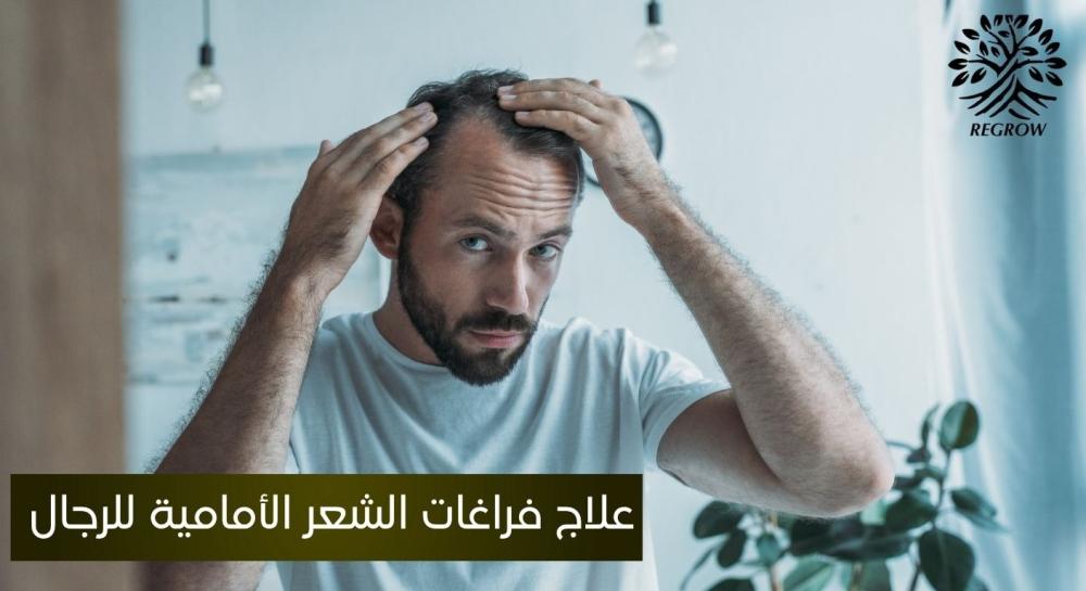 علاج فراغات الشعر الأمامية للرجال
