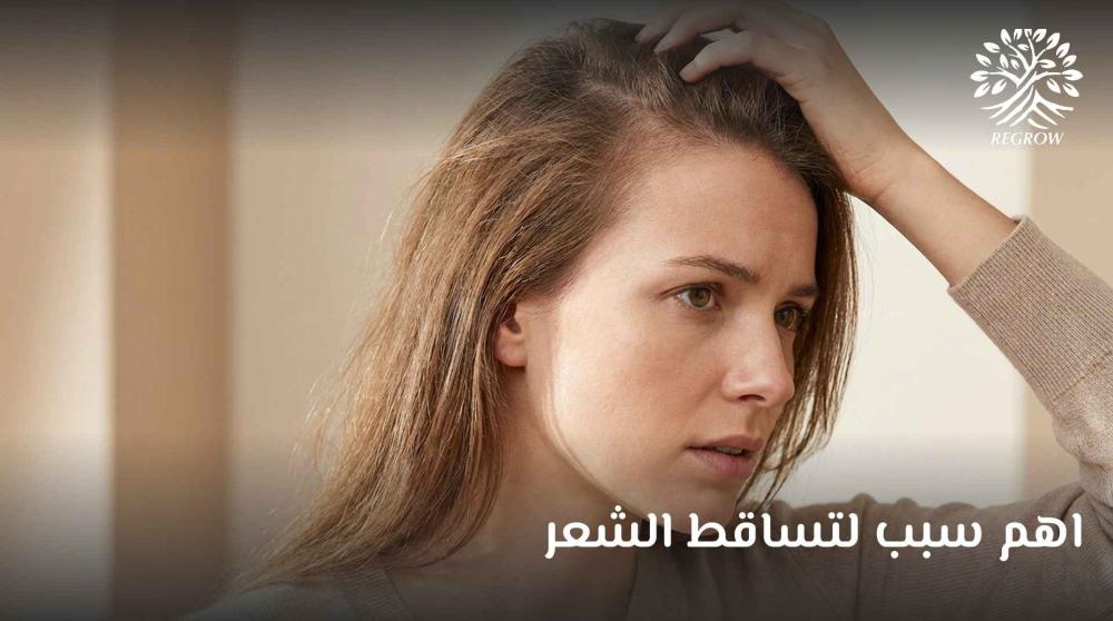 اهم سبب لتساقط الشعر