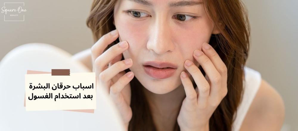 سبب حرقان الوجه بعد الغسول