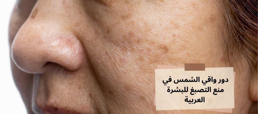 دور واقي الشمس في منع فرط التصبغ للبشرة العربية
